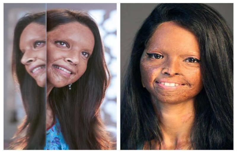 छपाक फिल्म में दीपिका पादुकोण करेंगी लक्ष्मी का रोल