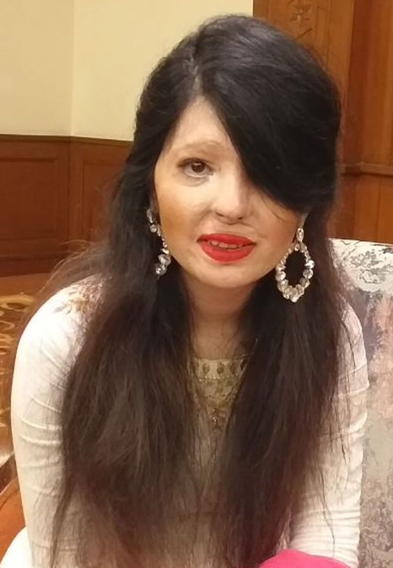 वंडर, पहले कभी नहीं सुना होगा कि जिसका चेहरा तेजाब डाल जला दिया, वह अब फैशन की दुनिया में कमाल दिखा रही है