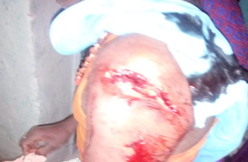 Bear Attack: आंगन में बैठे एक ही परिवार के तीन लोगों को भालू ने नोंचा