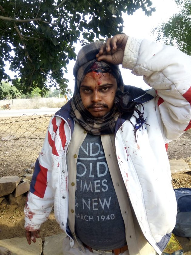 लकड़ी काटने से मना किया, तो वनरक्षक व चौकीदार पर किया कुल्हाड़ी से हमला