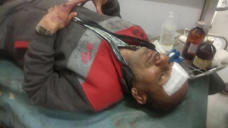 Attack on hospital premises, one person injured