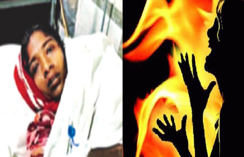 पति ने की पत्नी को जलाकर मारने की कोशिश