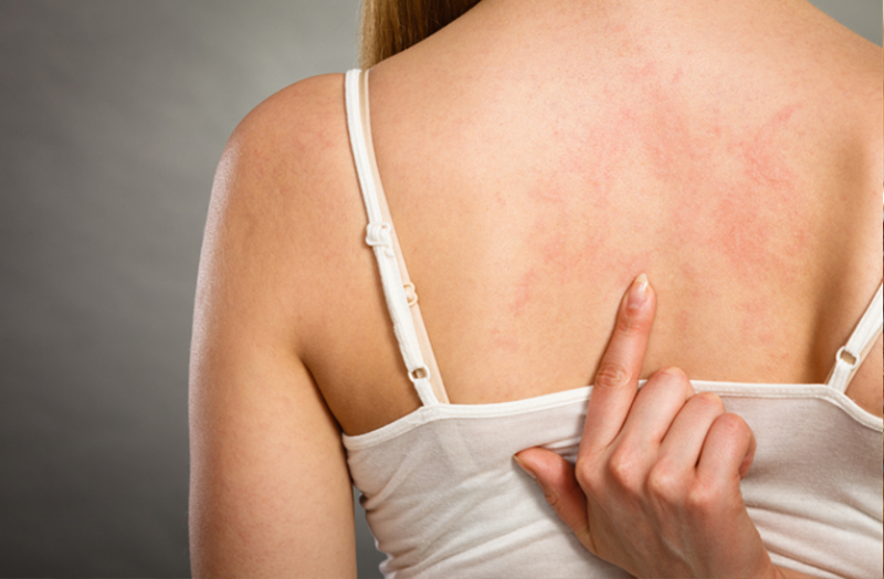 सर्दी में खुजली की समस्या ज्यादा होती है, जानें इससे बचने के तरीके