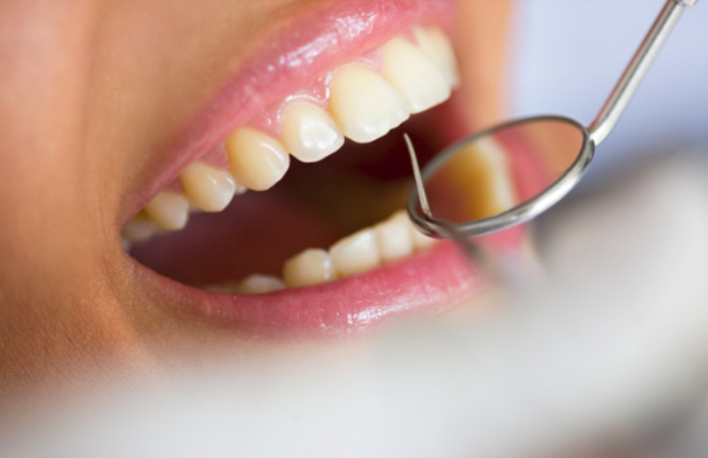 Root Canal Treatment Procedure and cost