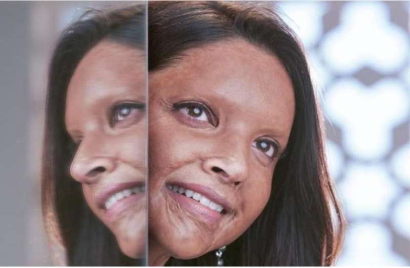 छपाक पर सियासत: कांग्रेस नेता ने खरीदी फिल्म की 200 टिकट, ABVP के कार्यकर्ताओं ने किया विरोध