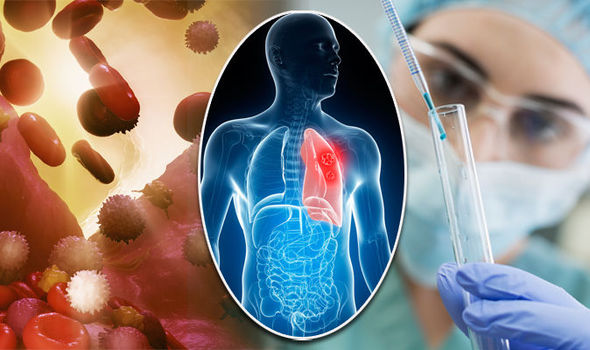 lung-cancer-symptoms-scientists-have-made-a-big-step-towards-making-an-exciting-treatment-possible-818847.jpg
