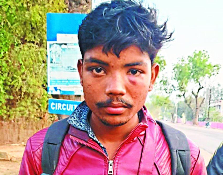 Youth beaten with sticks, robbed bike and mobile