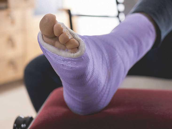 fracture.jpg