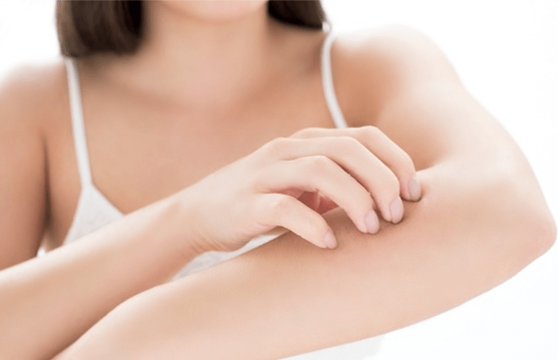 Follow these tips to avoid itching of skin during winter