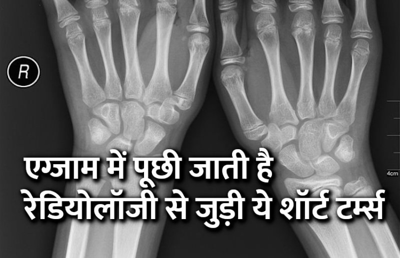 Education, interview, exam, online test, rojgar samachar, interview tips, online exam, Mock Test, general knowledge, GK, interview questions, jobs in hindi, rojgar, competition exam, mock test paper, sarkari job, questions Answers, GK mock test, Exam Guide, General Science Questions, Questions and answers, common general knowledge questions and answers, common general knowledge questions and answers, GK, short terms