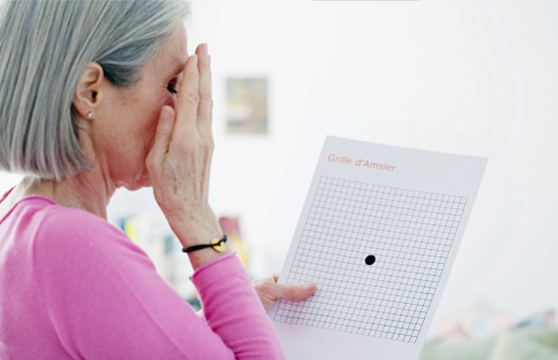 FHR4 Protein leads age-related macular degeneration