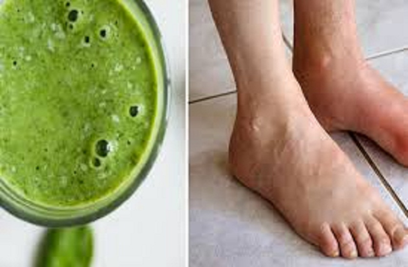 बढ़े यूरिक एसिड में लें ये डाइट