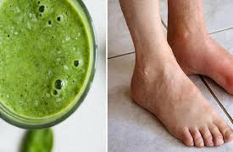 बढ़े यूरिक एसिड में लें ये डाइट