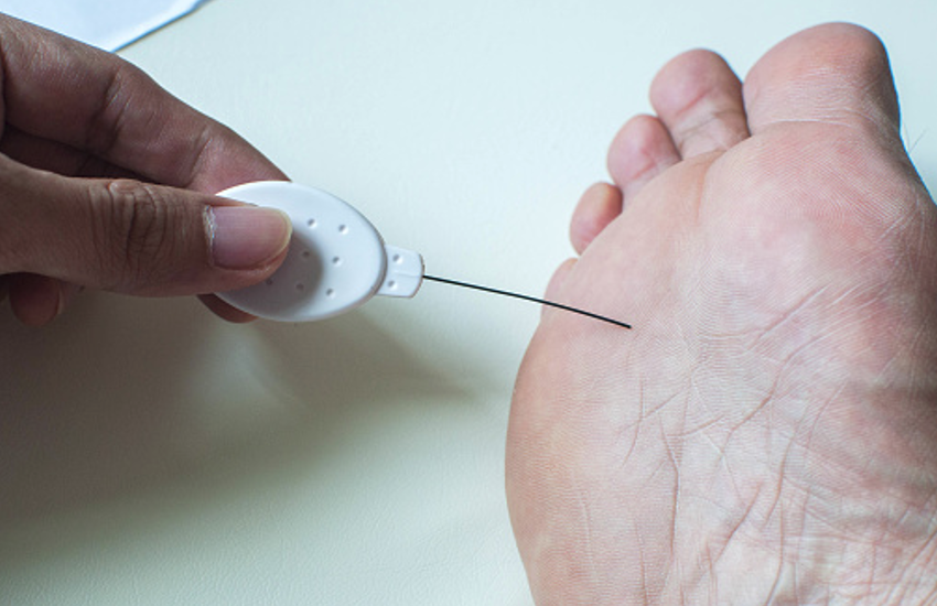 Diabetic Neuropathy: Tips to prevent Nerve Damage in Diabetes