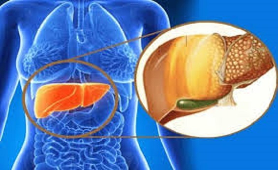 Fatty liver disease health news