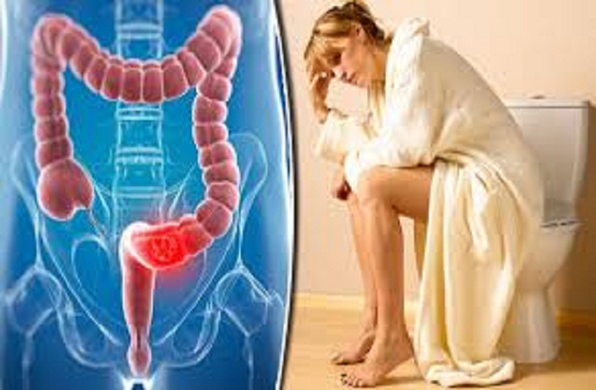 ज्यादा देर बैठने व कब्ज से पाइल्स, भरपूर पानी पीएं
