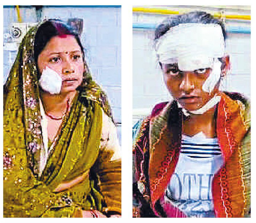 Woman and teenager injured in Harsh firing