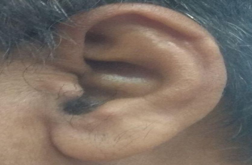 तेज आवाज छीन सकती है सुनने की शक्ति