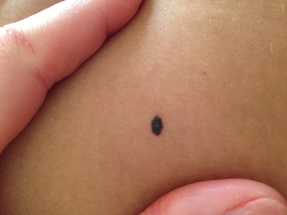 आपके शरीर के इस अंग पर भी है तिल तो आप हैं सबसे लकी, मिलता है सच्चा प्यार