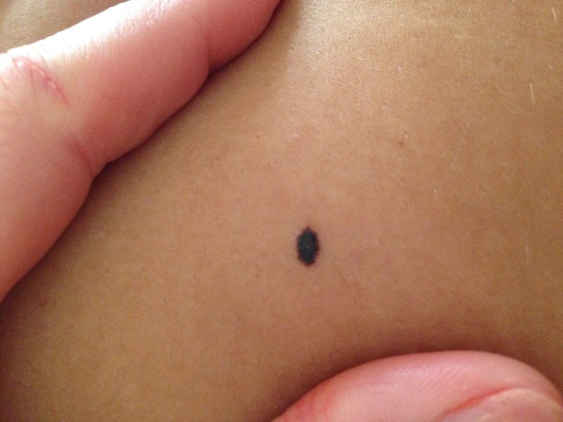 आपके शरीर के इस अंग पर भी है तिल तो आप हैं सबसे लकी, मिलता है सच्चा प्यार