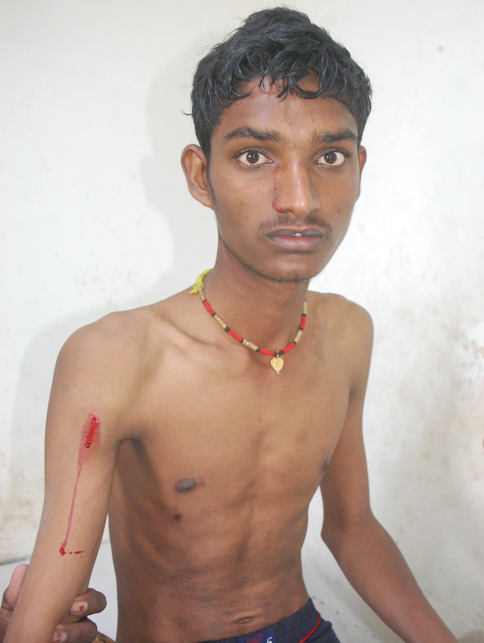 Leopard attacked young man who left water in wheat field, injured by claw