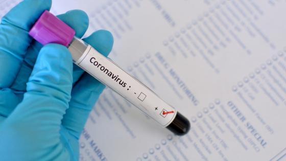 coronavirus_test.jpg