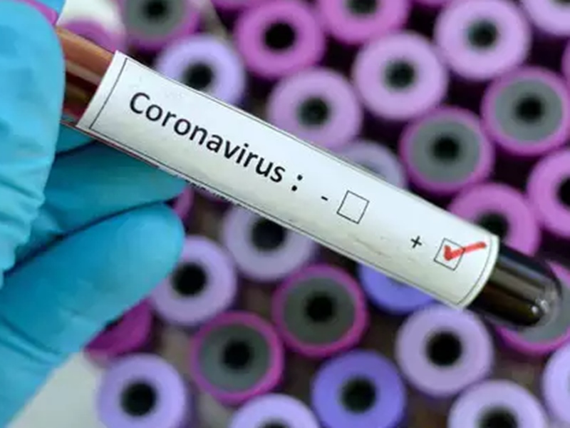 Corona virus covid 19 Italy China
