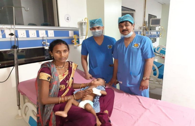 18 माह की मासूम के थे तीन हाथ, डॉक्टरों ने अलग किया