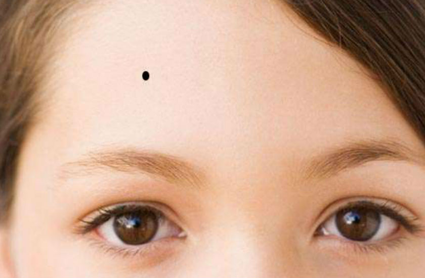 mole_on_head.jpg