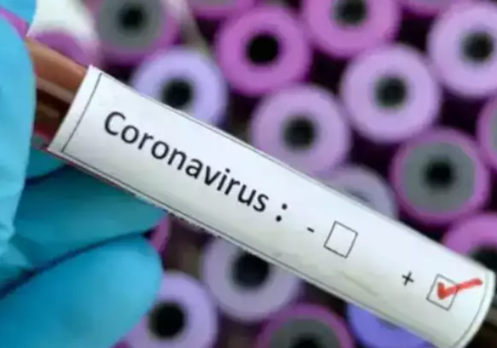 हवा-पानी से नहीं अफवाहों से फैलता है कोरोना वायरस