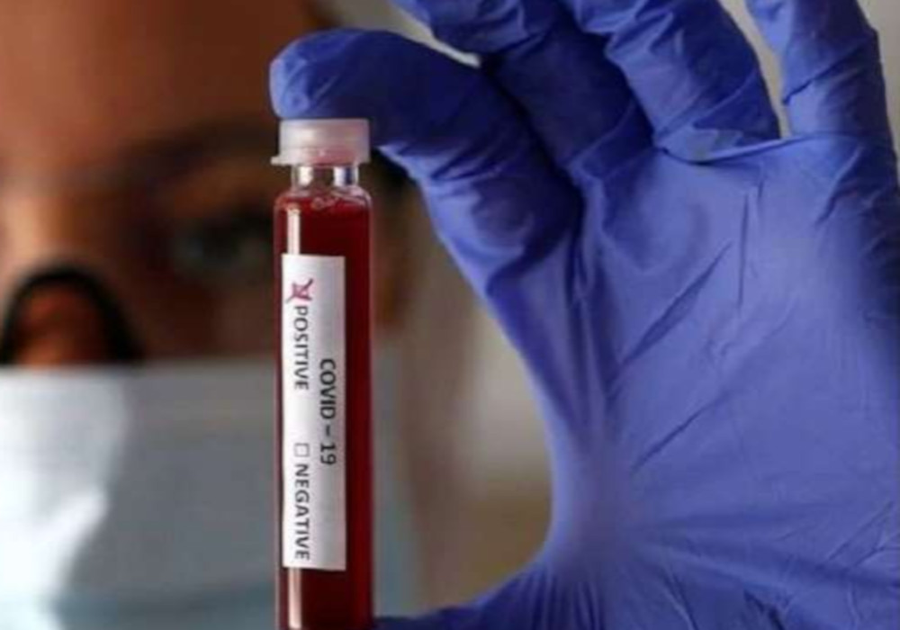 उत्तर प्रदेश में दो कोरोना वायरस पॉजिटिव, मंत्री समेत 45 की जांच रिपोर्ट आई निगेटिव