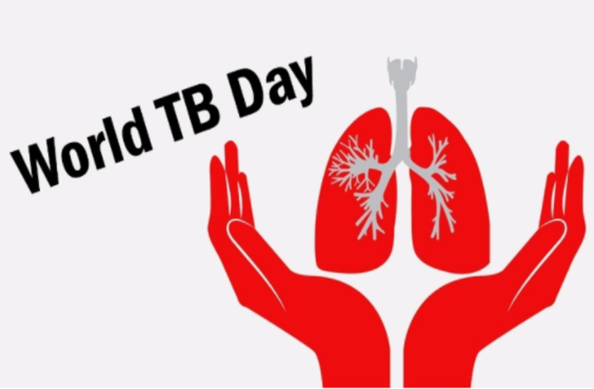 World TB Day: तेजी से फैलता है टीबी रोग, सावधान रहें, सुरक्षित रहें, ये लक्षण दिखाई देते ही कराएं जांच