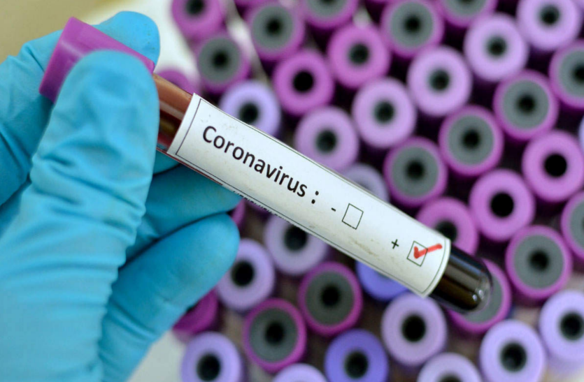 आंध्र प्रदेश: एक दिन में मिले 67 Coronavirus पॉजिटिव, आंकड़ा पहुंचा 100 पार