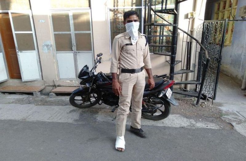 कोरोना से जंग में मुस्तैद: पैर में फ्रैक्चर, फिर भी ड्यूटी पर डटे रहे कर्मवीर