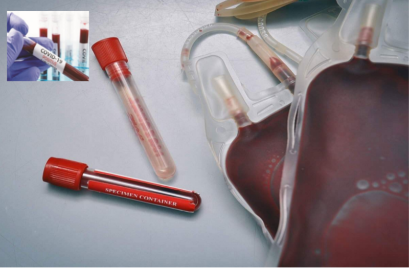 COVID-19: प्लाज्मा थेरेपी के जरिए होगा कोरोना रोगियों का