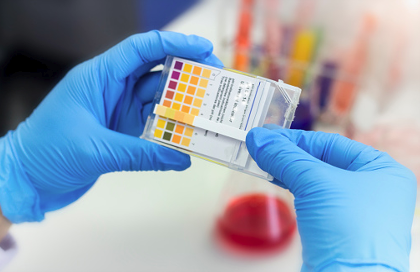 Coronavirus update: Feluda a Low-Cost Paper-Strip Test For Covid-19