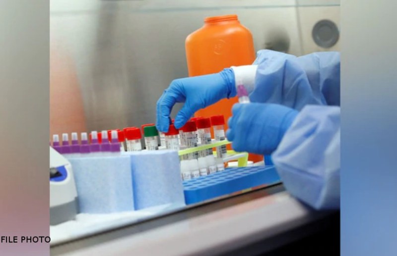 छत्तीसगढ़ में कोरोना लैब को नहीं मिल रही मंजूरी,मेडिकल कॉलेजों में टेस्टिंग संसाधनों की कमी बना कारण