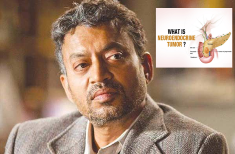 जानिए क्या है न्यूरोएंडोक्राइन ट्यूमर (एनईटी) बीमारी, जिससे हुआ इरफान खान का निधन