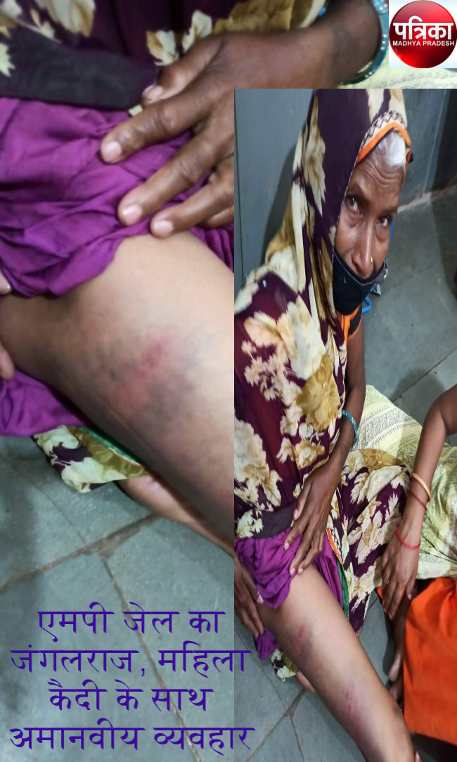 बुजुर्ग महिला कैदी को नींद आने पर जेल में बुरी तरह पिटाई, गंभीर