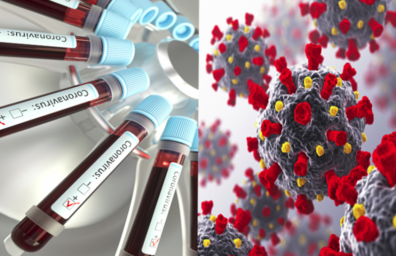 suPAR Protein could predict which coronavirus patient need ventilators