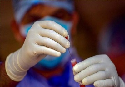 एसएन में जल्द शुरू होगा प्लाज्मा थैरेपी से कोविड का इलाज, आईसीएमआर से मांगी अनुमति