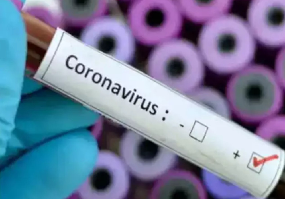 UP Top News: यूपी में कोरोना वायरस का खतरा बढ़ा, आठ दिन में 2033 नए केस मिले