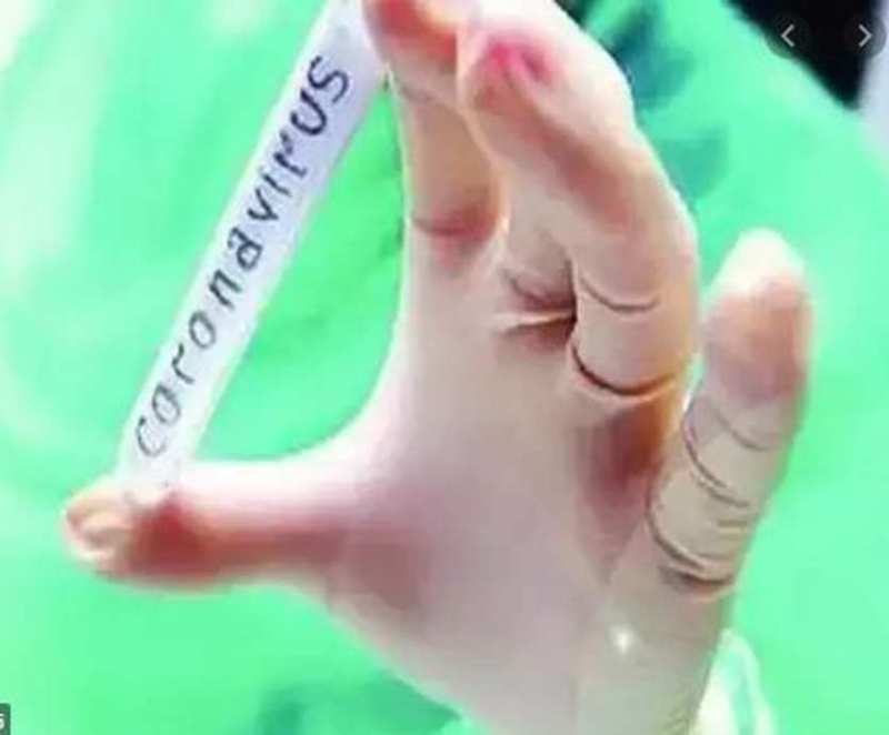 सेलम में कोरोना के 49 नए मामले