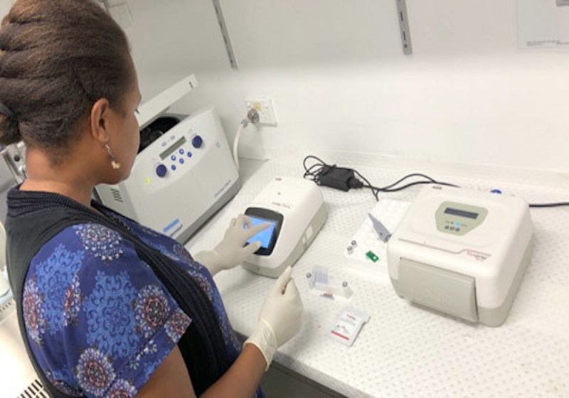 एक मशीन से चार मरीजों की हो सकेगी जांच, ट्रूनट मशीन तुरंत देगी संक्रमण की जानकारी