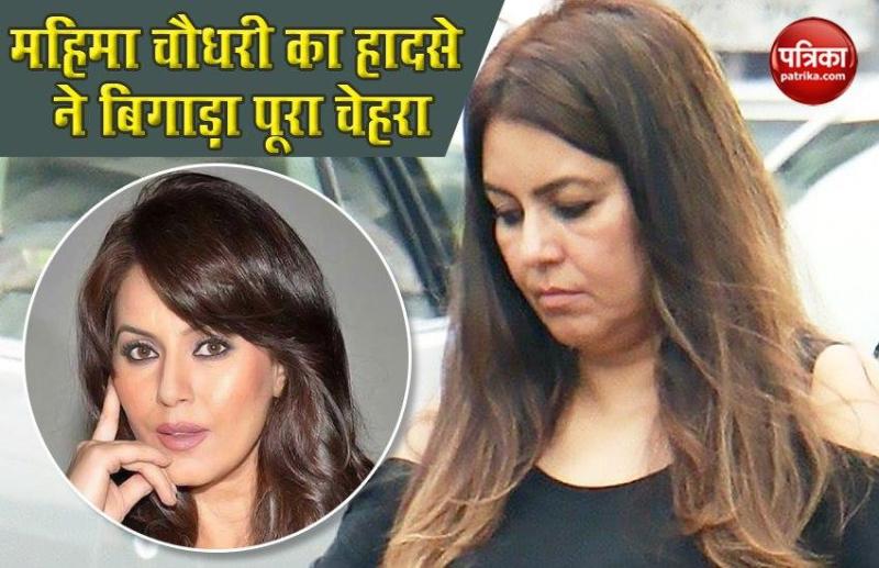 Mahima Chaudhry opened up about her Massive Accident
