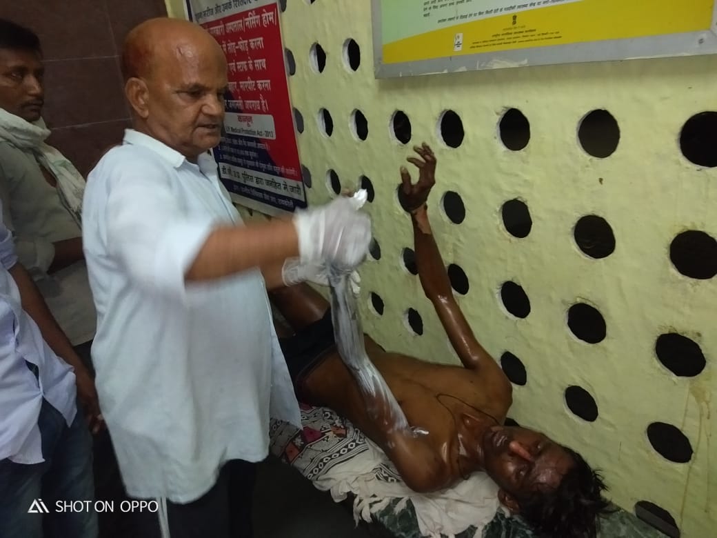 रायबरेली में मेंथा की पेराई के दौरान टँकी फटने से मजदूर झुलसा,गंभीर हालत में अस्पताल में भर्ती