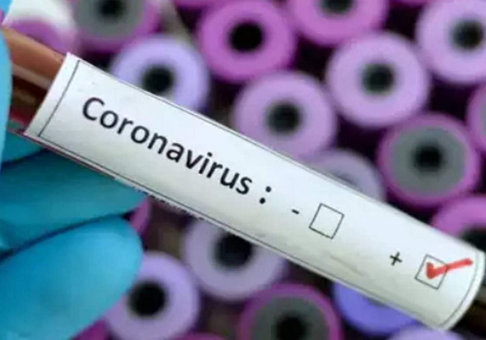 यूपी की आम जनता के लिए राहत, प्राइवेट लैब में अब 2500 रुपए में होगा कोरोना टेस्ट, पहले देने पड़ते थे ढेर सारे पैसे