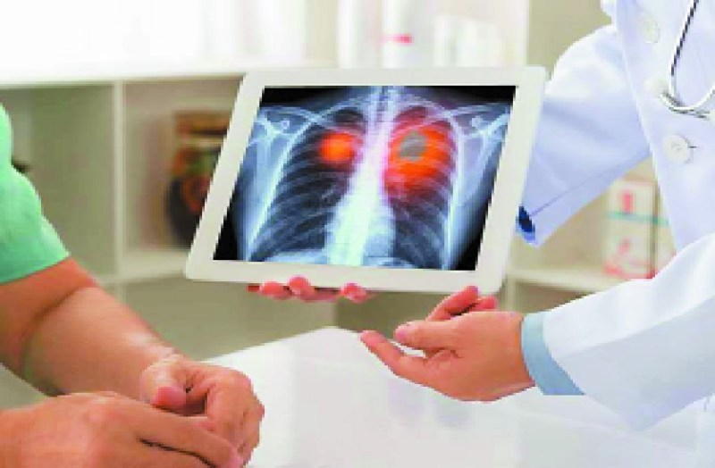 Yoga and meditation: फेफड़ों की सूजन कम होती, कोविड-19 से बचाव