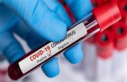 Coronavirus