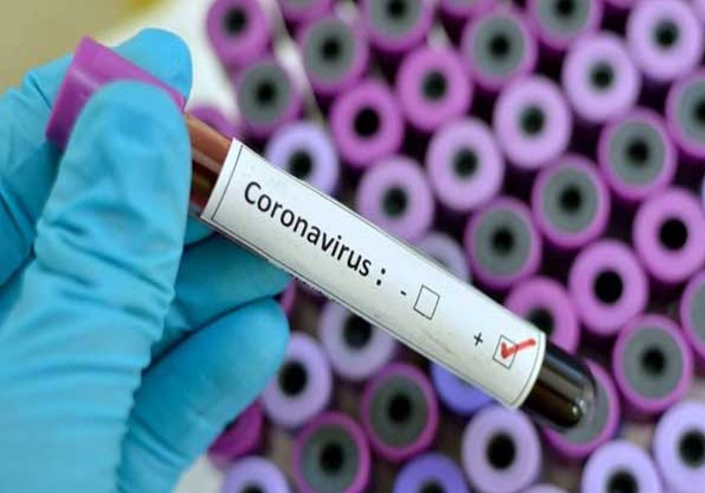 आजमगढ़ में फिर मिले 7 कोरोना पॉजिटिव, कुल संक्रमितों की संख्या 220